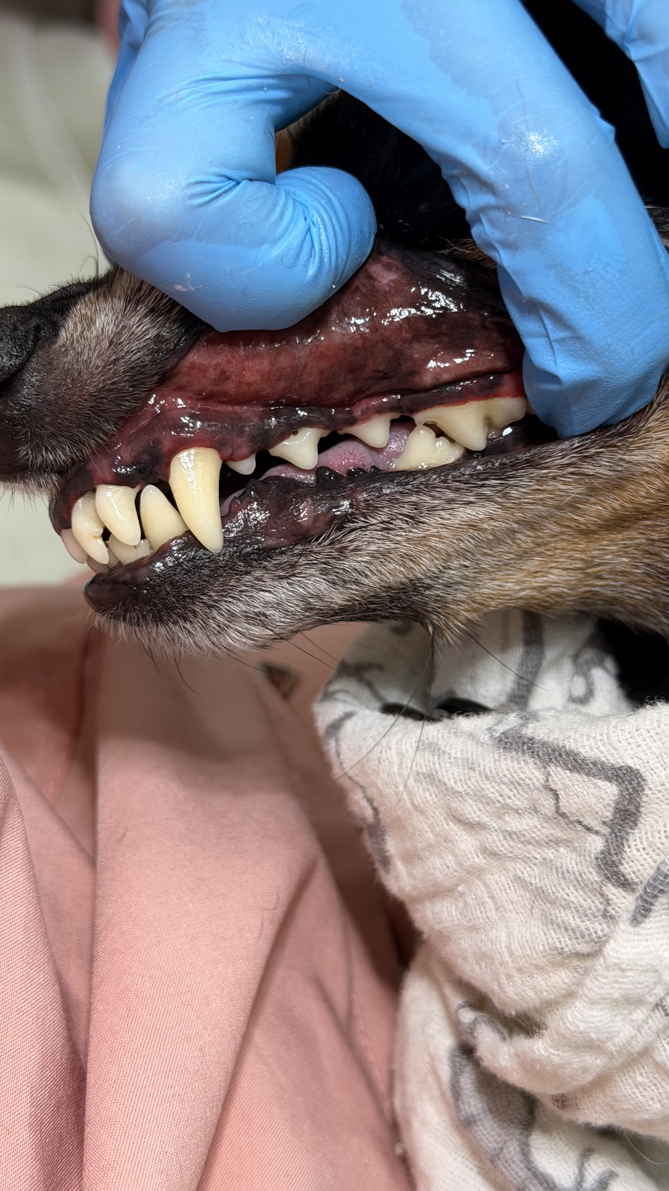 After - Mild tartar removal left side