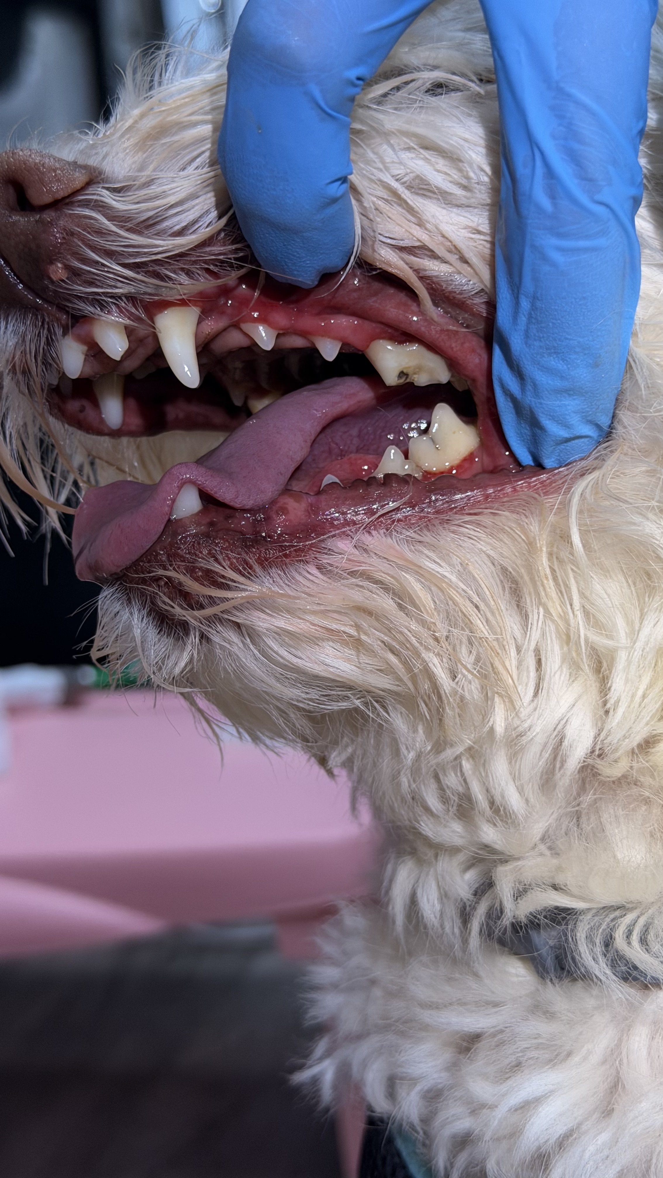 After - Cavities under heavy calculus (tartar)