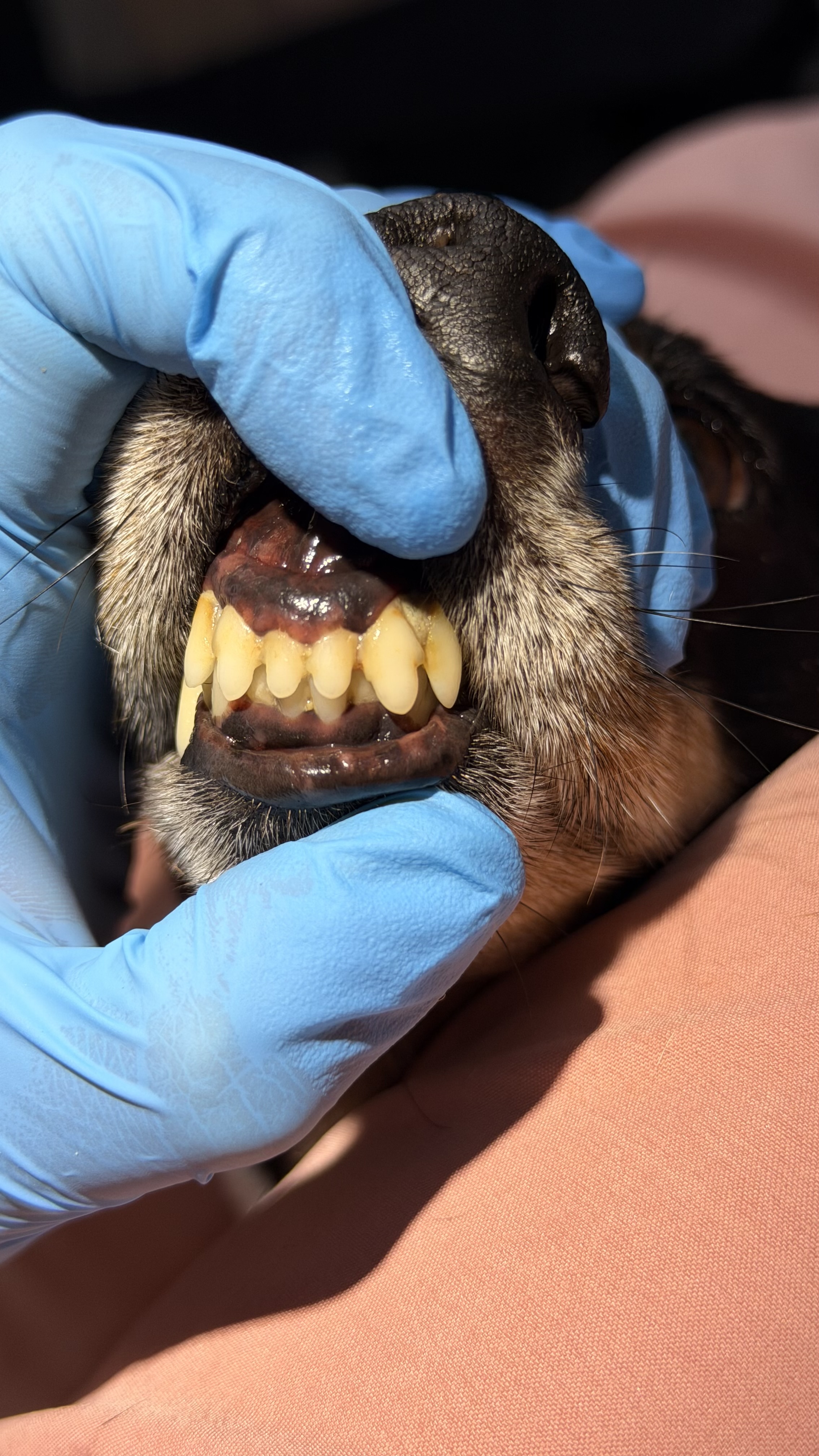 Before - Mild tartar removal