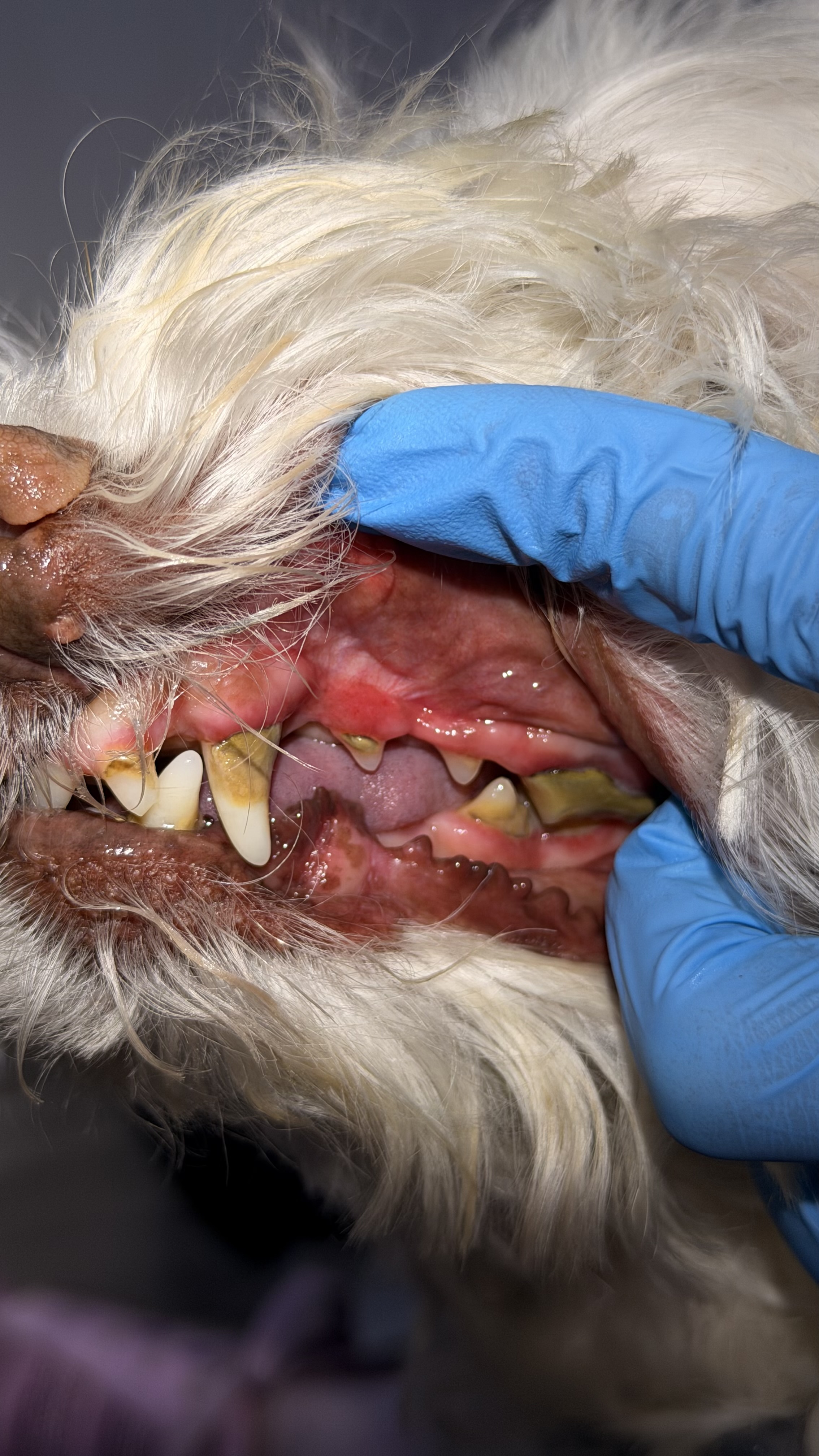 Before - Cavities under heavy calculus (tartar)