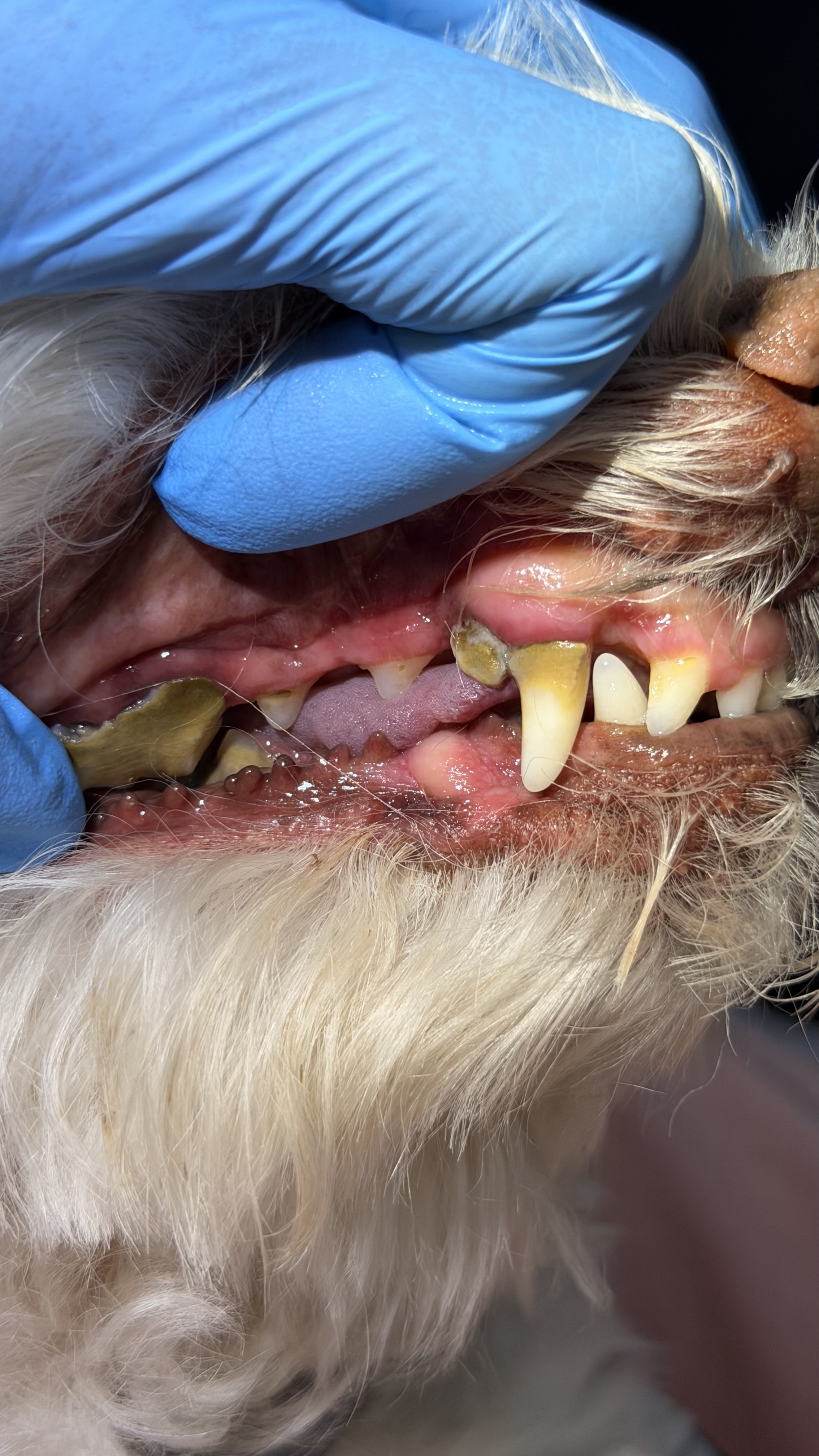 Before - Cavities and a fracture hidden under heavy calculus 